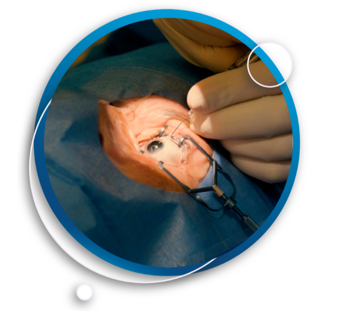 Shri Ganesh Eye Hospital | Services